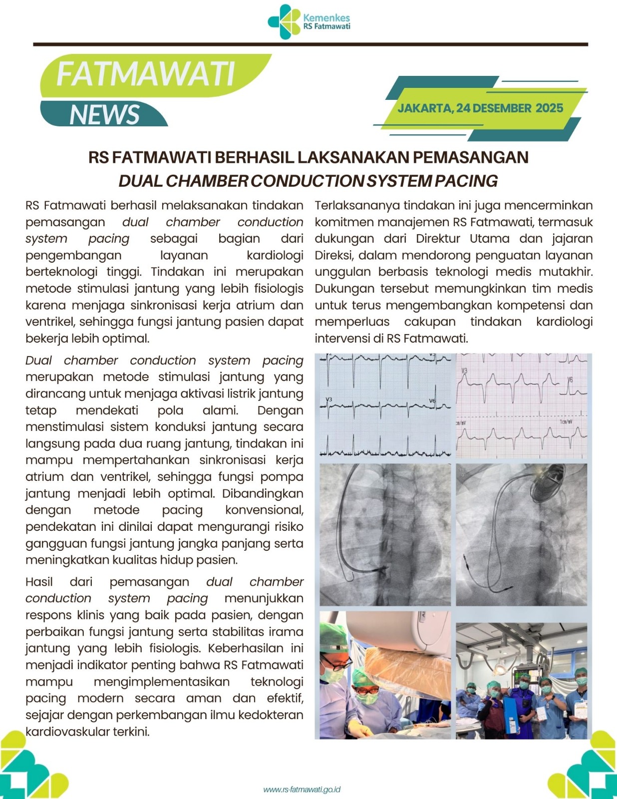 RS Fatmawati Berhasil Laksanakan Pemasangan Dual Chamber Conduction System Pacing